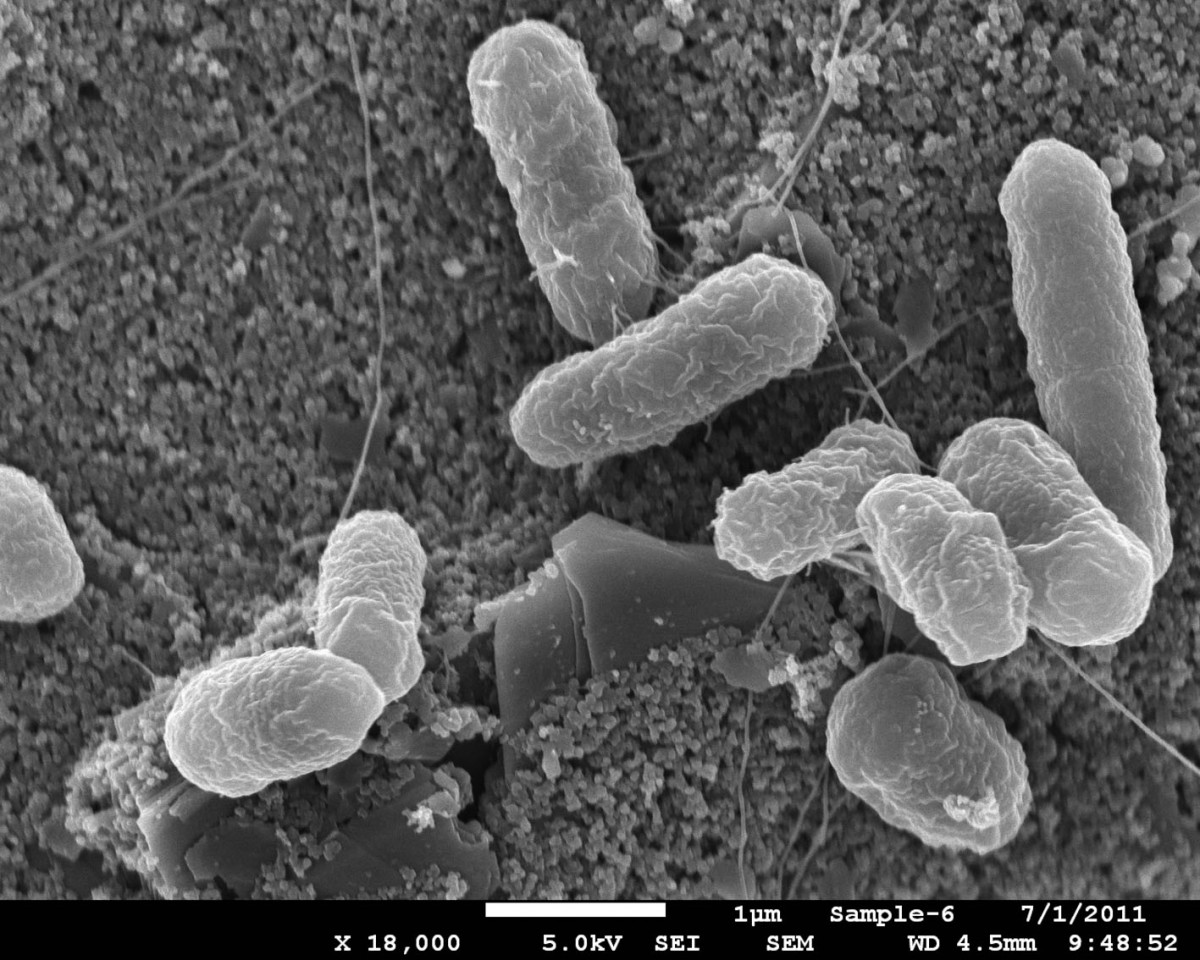 coli paraziták kell e profilaxis a paraziták ellen